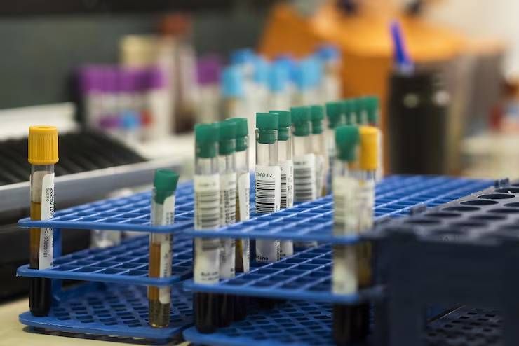 IL-6 ELISA Kits Explained: Assay Technologies, Detection Methods, Sensitivity, Manufacturing and Research Applications