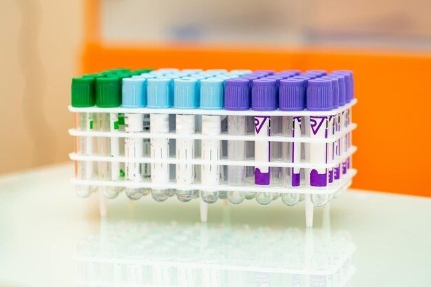 IL-6 ELISA Kits Explained: Principles, Applications & Research Use